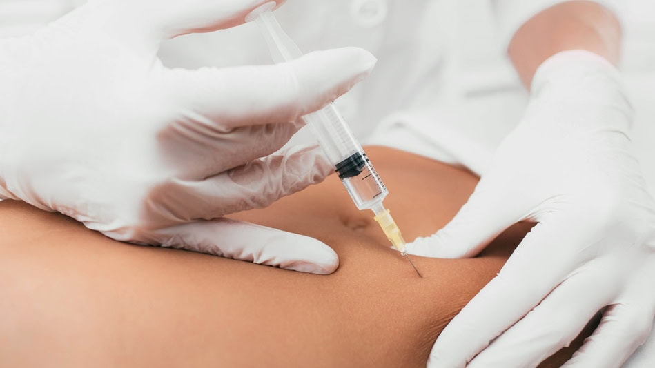 La mesoterapia corporal se orienta hacia áreas como abdomen, glúteos, muslos y brazos