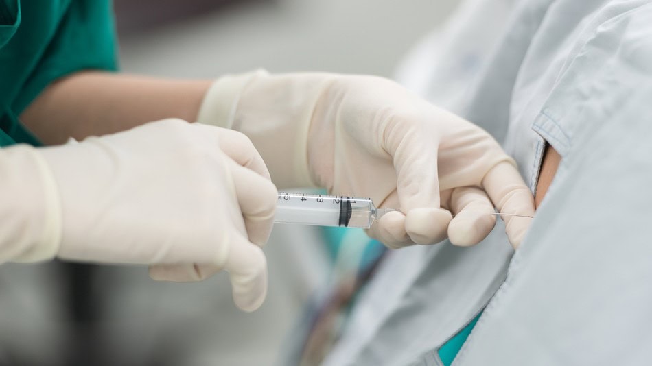 La anestesia regional en pediatría se clasifica según la zona del cuerpo donde actúa y el tipo de intervención que se va a realizar